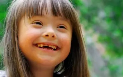 Press Release – 4% increase in abortions where baby had disability in Scotland, as momentum grows to stop abortion up to birth for babies with Down’s syndrome
