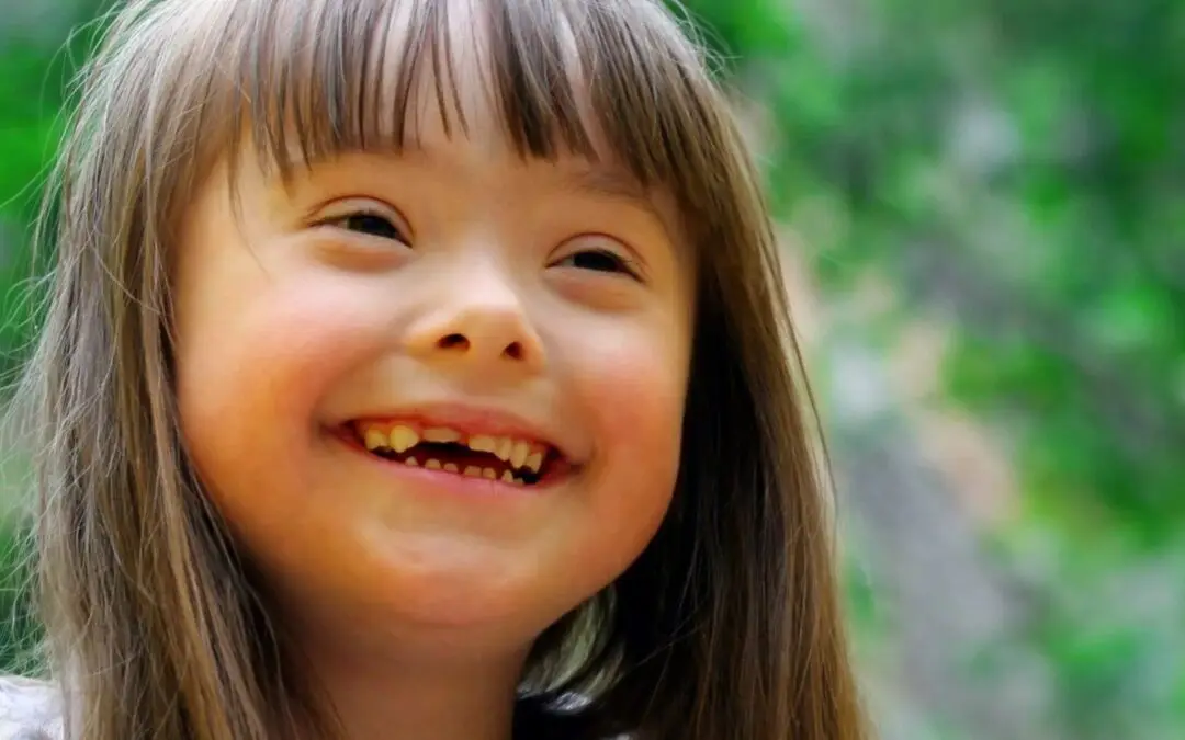 Press Release – 4% increase in abortions where baby had disability in Scotland, as momentum grows to stop abortion up to birth for babies with Down’s syndrome